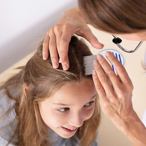 Understanding Super Lice Why Are They Harder to Eliminate